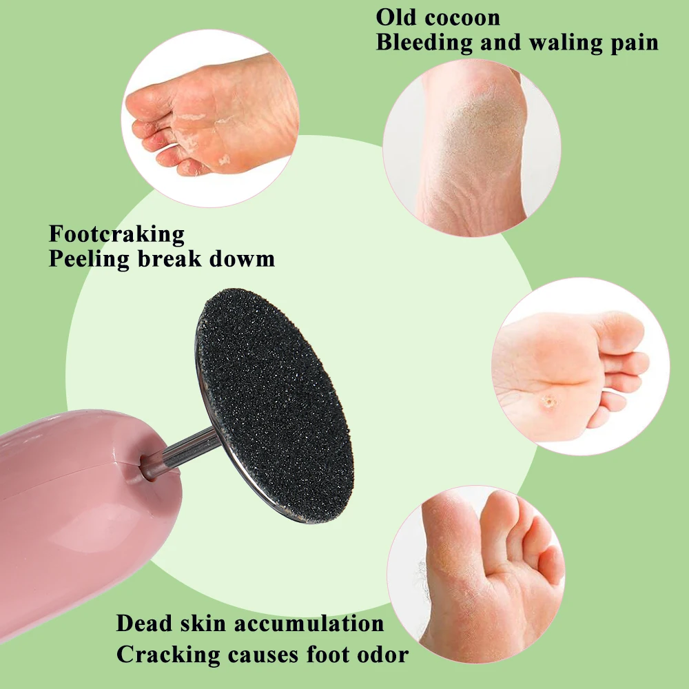 Pedicure Vervanging Schuurpapier-15mm 20mm 25mm 35mm Voet Eelt Verwijderen Disc Refill Dode Huid Cuticle polijsten Bestand Accessoire