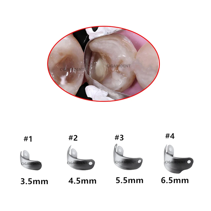 Dental Matrix Band Ring Palodent V3 Style Sectional Matrix System Dental Matrix Band Clamp Style 3D Wedges Matrix Plier