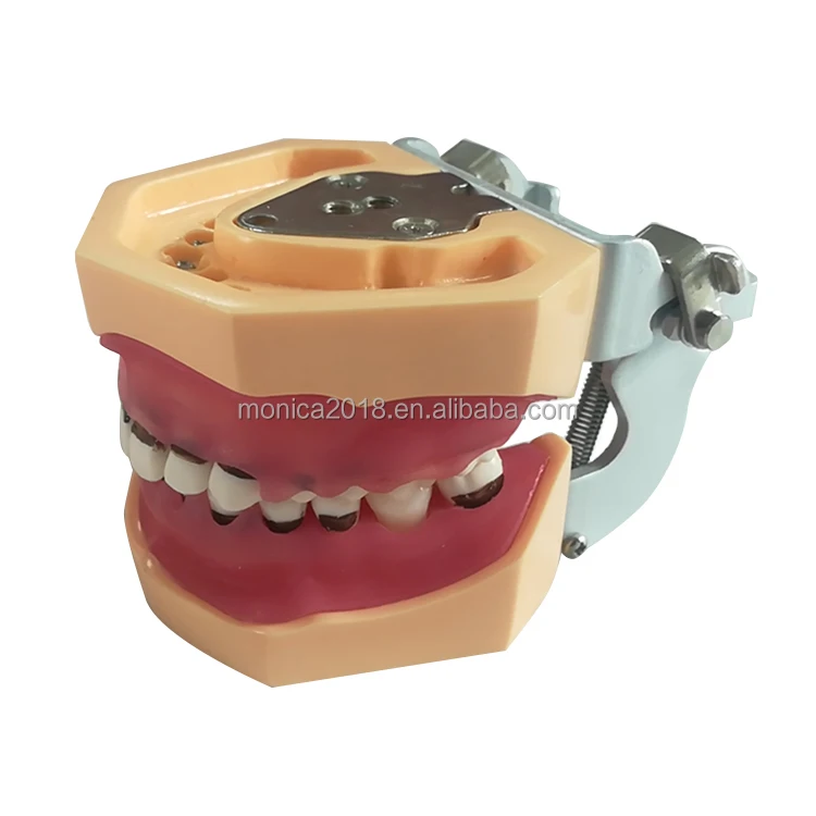 

den tal Medicine Science Education Model Practice Human Teeth Oral Model Periodontal Disease Model