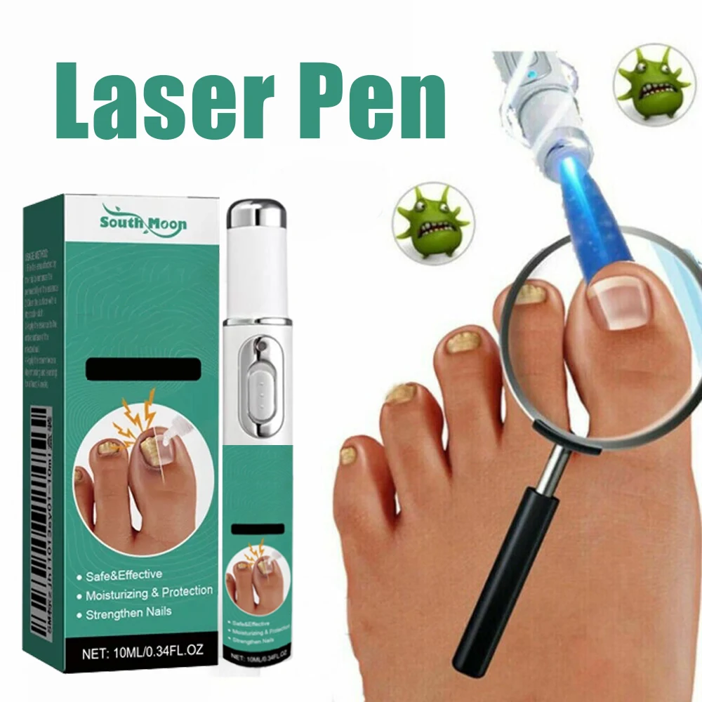 

Laser Nail Fungus Treatment Device – Removes Toenail & Fingernail Fungus, Effective Onychomycosis Cure for Fungal Infections