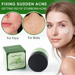 JoyPrettyin Herbal Acne Face Cream Pimple Marks Removal Oil Control Moisturizing Pockmark Smooth Facial Creams Skin Care Product