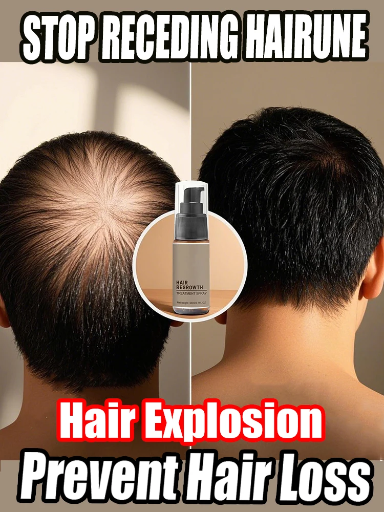 

Ginger Hair Growth Products for Men Women,Soothing Scalp,Nourish Hairs Roots,Improve Hair-Follicles and Grow Healthy Hair Serum