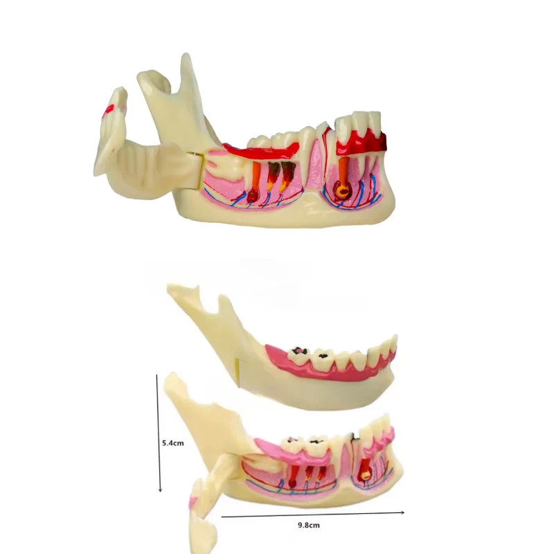 Dental Mandible Tissue Anatomical Model Endodontic Treatment Model Anatomy of Gums Dentist Teach Study Demonstration Teeth Model