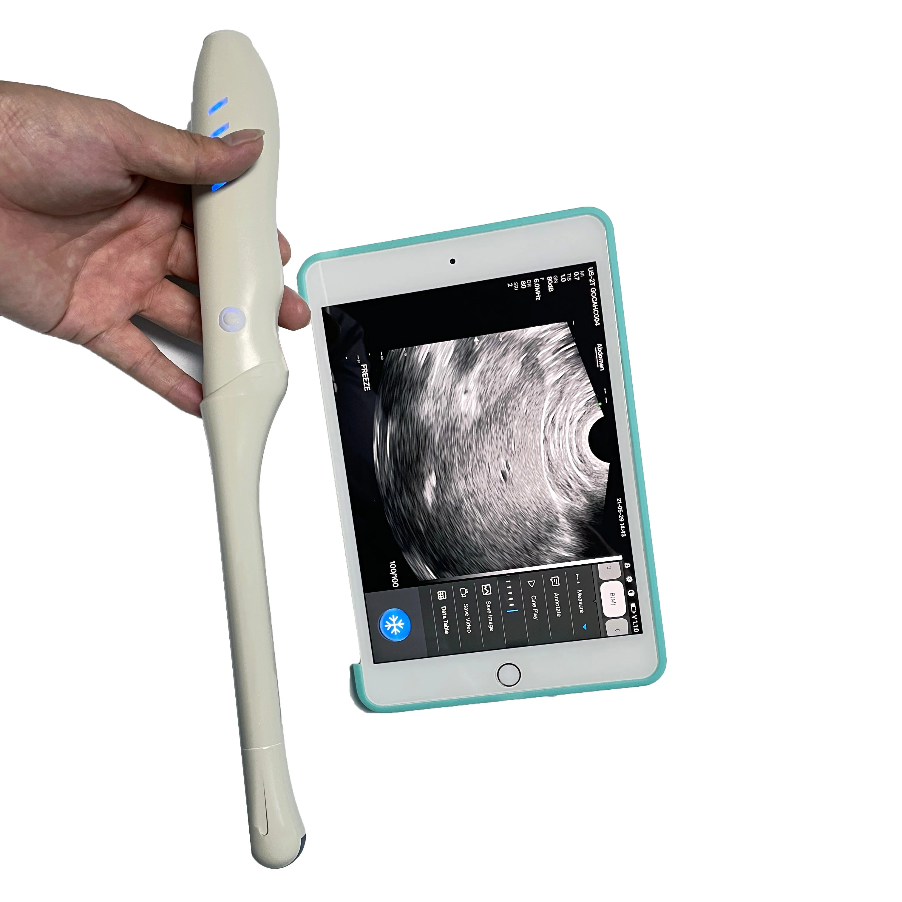 transvaginal array Endocavity ultrasonic wireless ultrasound probe