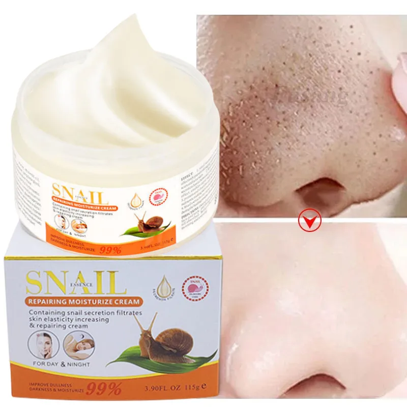 مزيل حب الشباب والرؤوس السوداء كريم التحكم في الزيت ، تقلص المسام ، إصلاح الترطيب ، تقليل العيوب ، كريم الحلزون المتقدم