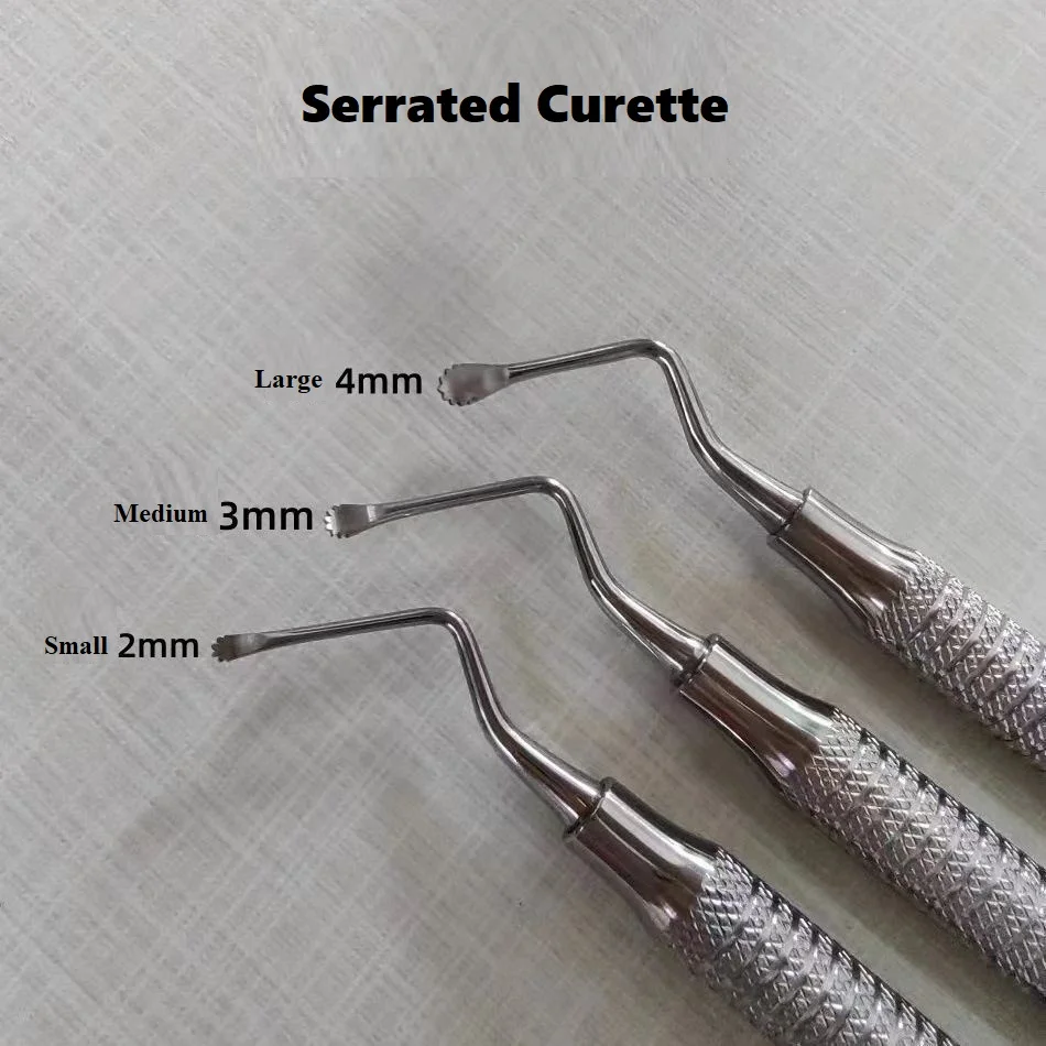 

Dental Spoon Curette / Excavator — Double-Ended, Serrated Dental Scraper / Cleaner