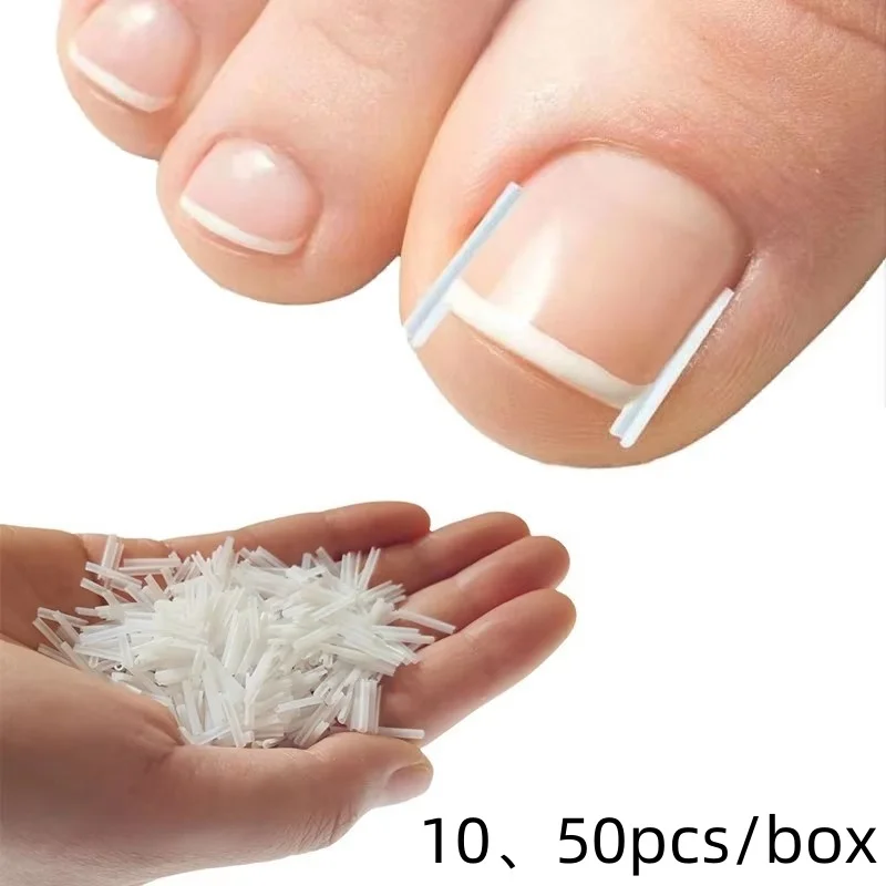 50Pcs Ingrown Toenail Correction Tool Ingrown Toe Nail Treatment Elastic Patch Sticker Straightening Clip Brace Pedicure Tool