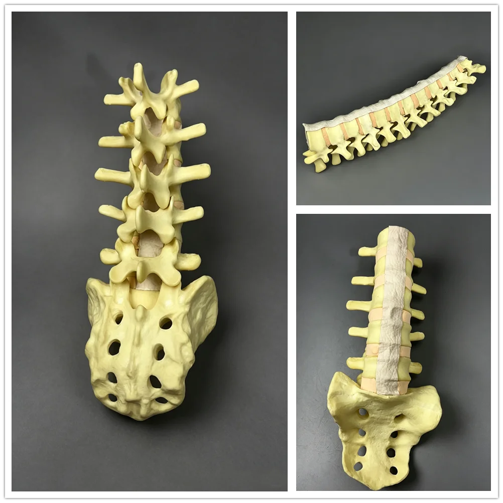 modello-anatomico-1-1-di-vertebre-toraciche-lombari-umane-in-schiuma-con-guscio-corticale-utilizzato-per-pratica-ortopedica
