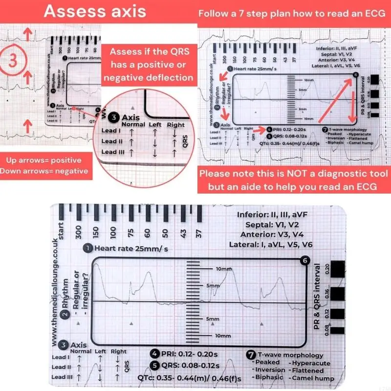 U75B Tragbare EKG-Interpretationsleitfadenkarte für eine genaue EKG-Interpretation