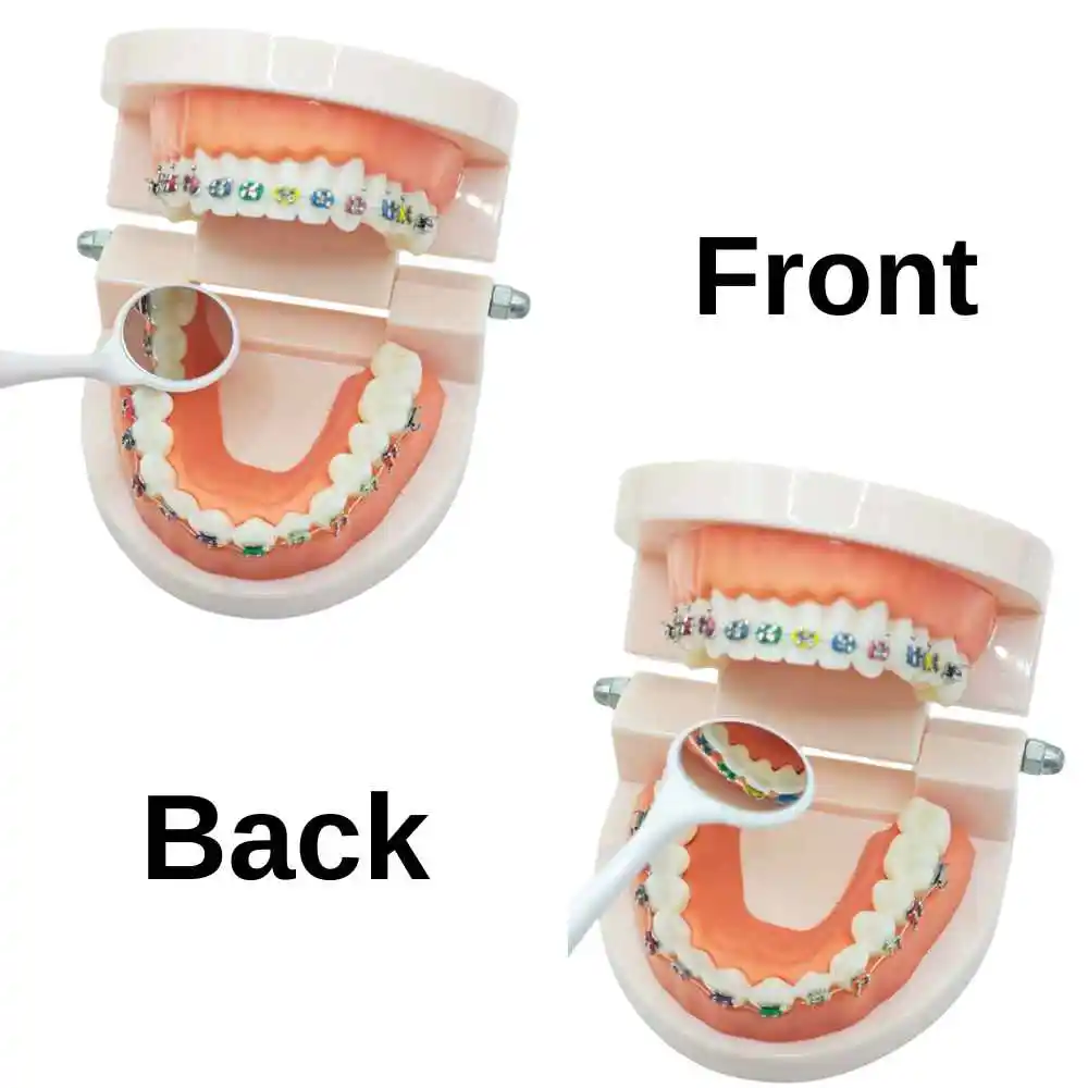 AG 10pcs/Box Oral Tooth Whitening Autoclavable Dental Double Sided Mouth Mirrors Surface Exam Reflectors With Handle