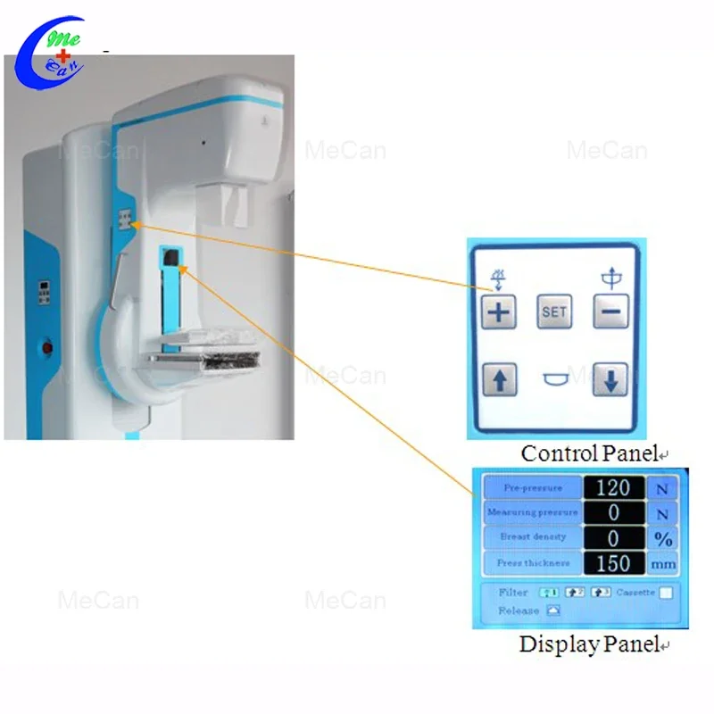 Medische Apparatuur, Digitale Röntgenfotografie, Röntgenapparaat Voor Digitale Mammografiesystemen