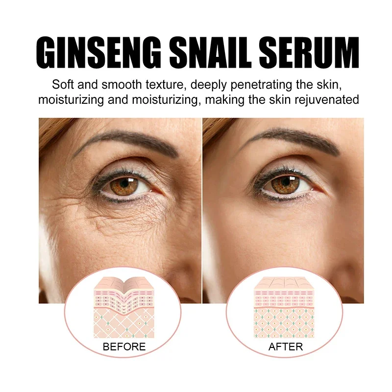 Ginseng Snail Serum Anti Wrinkle Aging Eye Face Lift Tightening Moisturising Smooth Fine Lines Brighten Korean Cosmetics 30ML