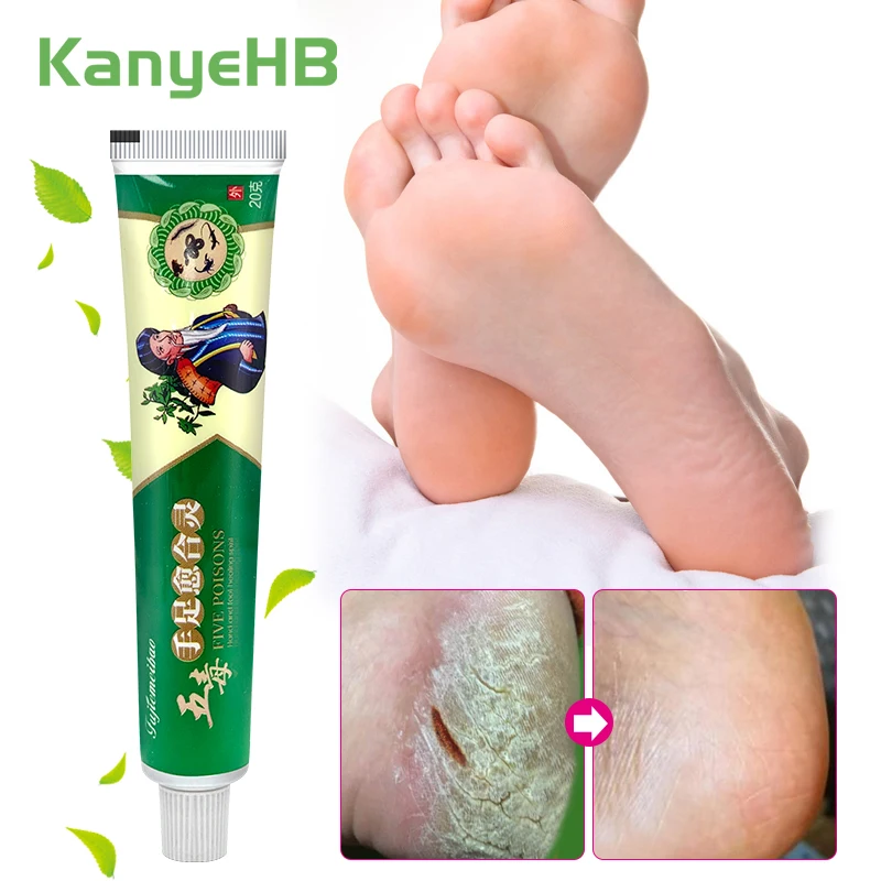 

1Pcs Antifreeze And Anti-cracking Foot Cream Moisturizing Repair Dry Skin Anti-Peeling Rough And Cracked Hands Feet Care S103