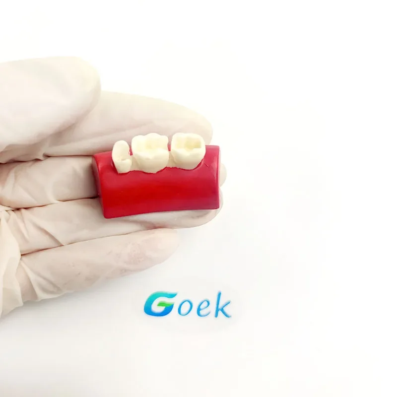 Dental Cultural Product Resin Block Filling Exercise Inlay Exercise Model Red/White Dentistry Tool Cultural Product