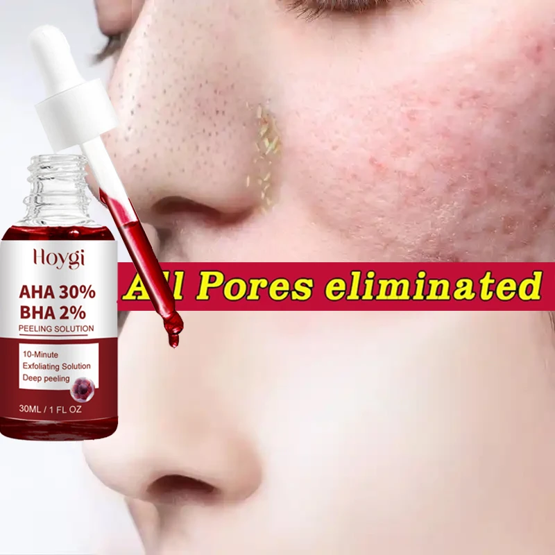 

Salicylic Acid Pore Shrinking Serum Peeling Face Removing Large Pores Tightening Minimizing Exfoliation Repairing Acne Skin Care