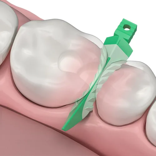 Imagen 2 del producto Bandas de matriz Dental NITI, anillo de abrazadera de matrices de Metal, sistema de matriz contorneada seccional, pinzas de cuñas compuestas interdentales dentales
