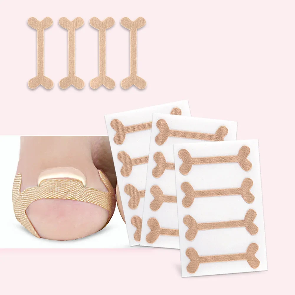 Tcare 1Set Toe Nail Groove Foot Nail Orthodontic Device Thumb Nail Patch Quick Pedicure Toe Nail Deformation Recover Foot Care