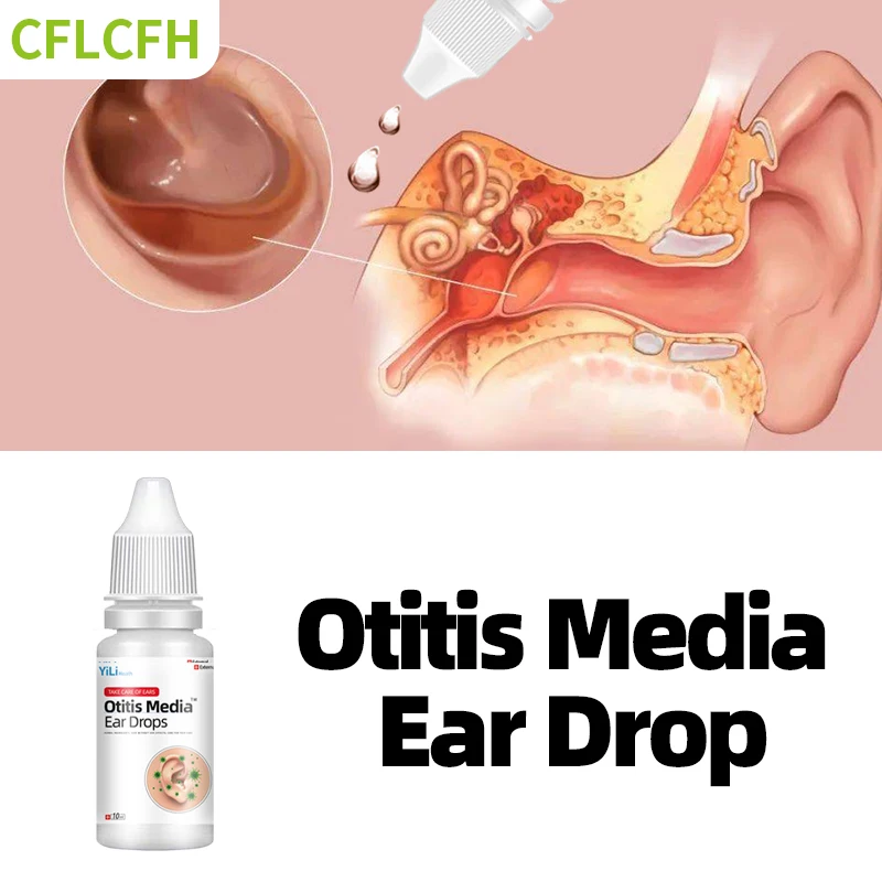 

10Ml Otitis Media Cure Ear Drop Ear Itching Pain Relief Acute Otitis Bacterial Infection Treatment Earwax Remover Cleaner Drops