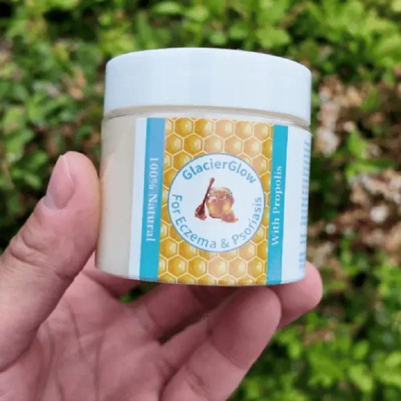 GlacierGlow Propolis Soothing Cream Deep Hydrating Moisturizing Dry Scalp & Skin Care Natural Honey Repair Cream for Face Body