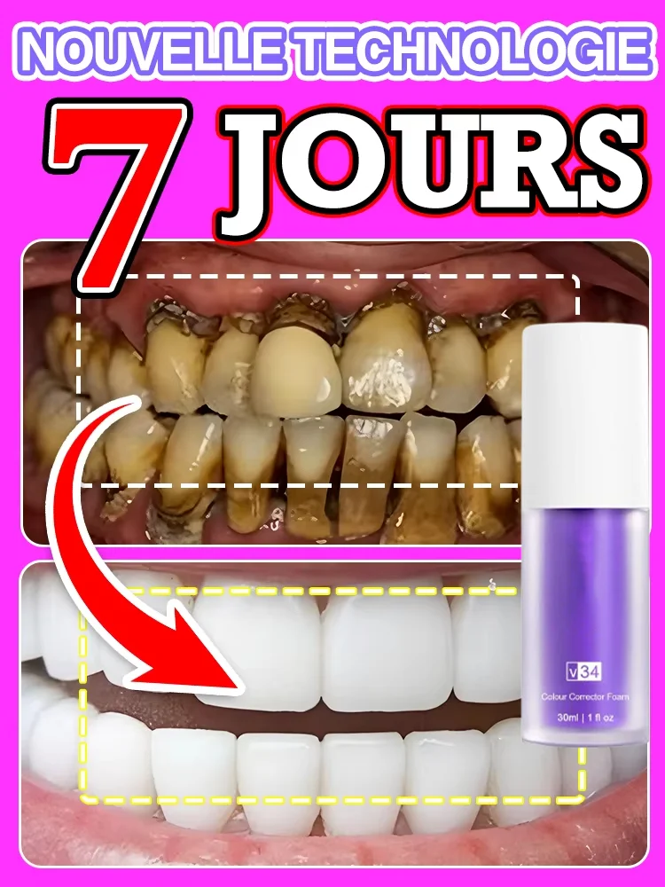 

Contains probiotics to clean teeth
