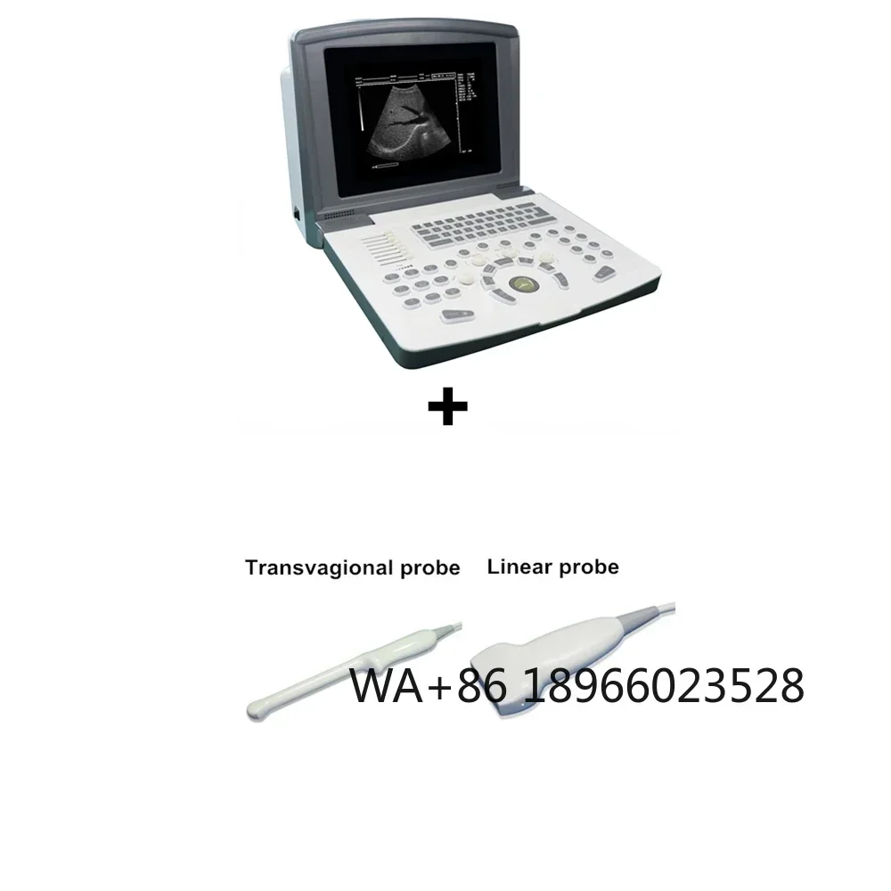 

10 Inch LED Laptop Portable B Ultrasound Scanner Echo Machine