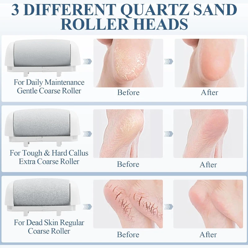 Nieuwe Elektrische Callus Remover Voor Voeten Oplaadbare Elektrische Voet Callus Remover Koppen Voet Grinder Voor Dode/Harde Gebarsten/Droge Huid