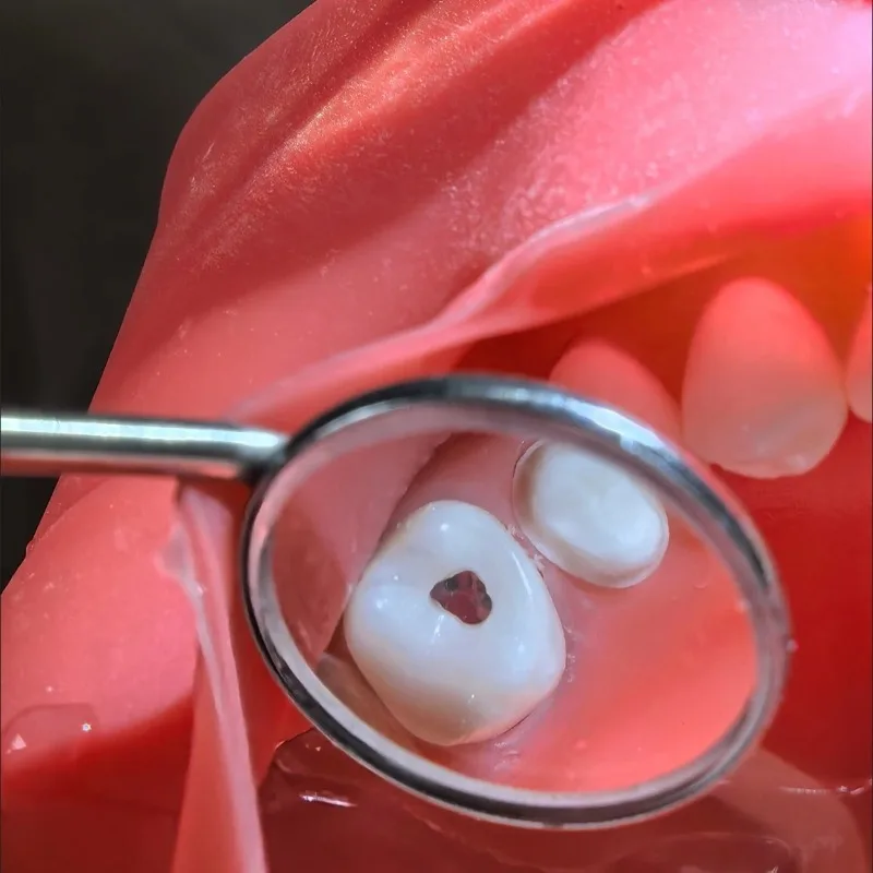 Dental Endodontic Practice Tooth Pulp Chamber Tooth Model Board Skill Practice Dental Lab Teaching Aid Reusable Demonstration