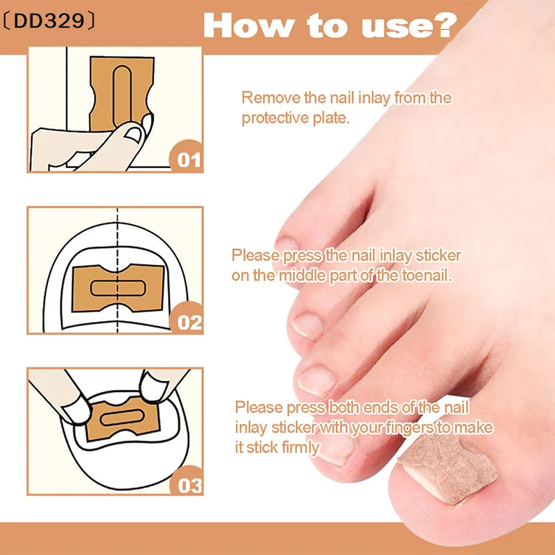 maveraDD329 Lapiza60Pcs Autocollants de Correction des Ongles Incarnés Patchs Correcteur d'ongle Patchs Traitement Récupérer Correcteur Pédicure Outil de Soin des Ongles