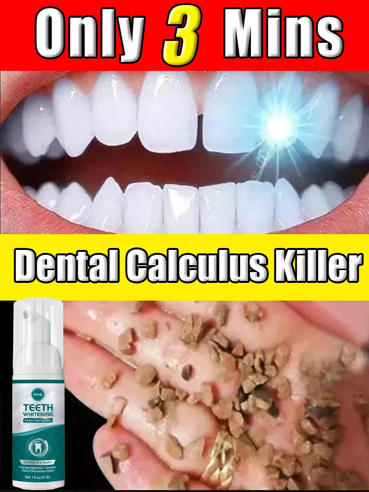 Dental Calculus Remover Bad Breath Removal Whitening Teeth Toothpaste Brightening Preventing Periodontitis Dental Cleansing Care