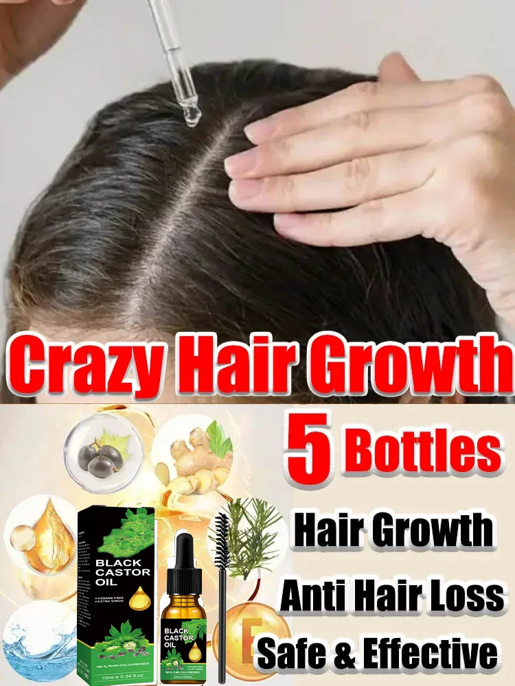 

Organic Black Castor Oil for Hair Growth Jamaican Scalp Dense Hair Strengthening Hair Loss Prevention Repair Nourishing Liquid