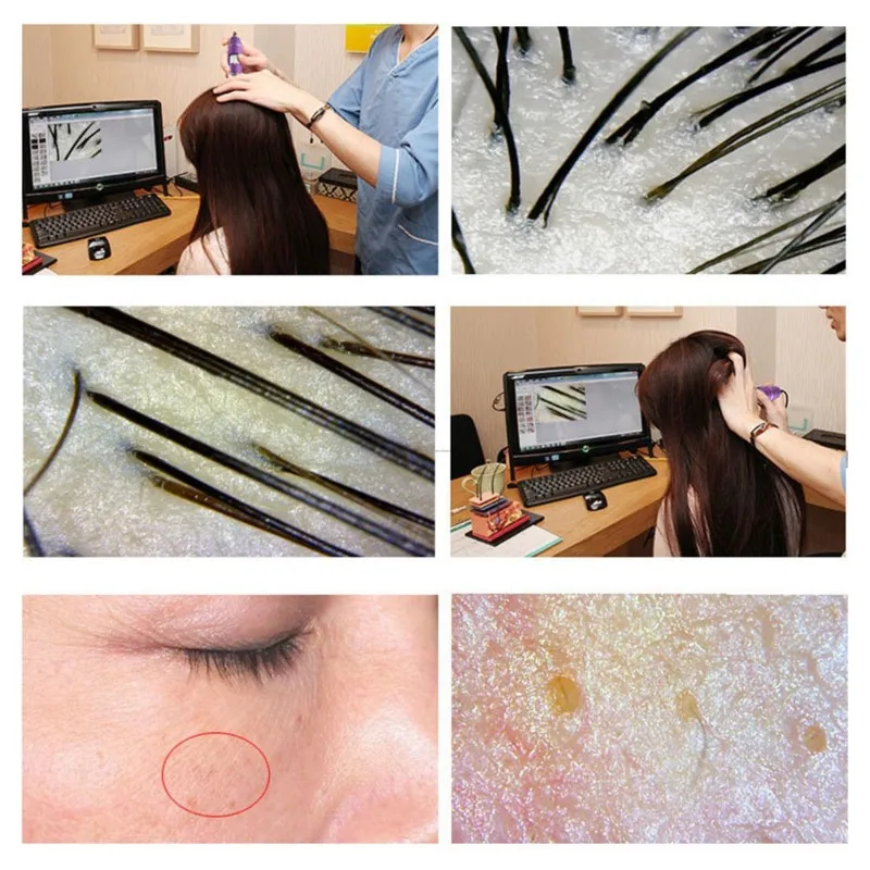 Retail HD Wifi Skin Hair Scalp Analyzer - Digital Microscope