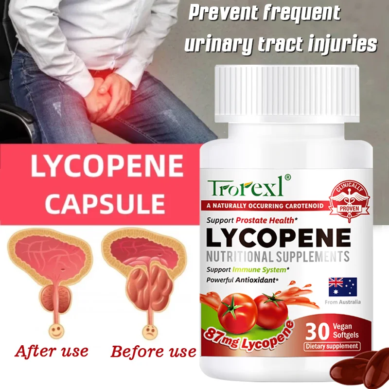 Lycopene Capsules Prostate Treatment Sperm Quality Supplement