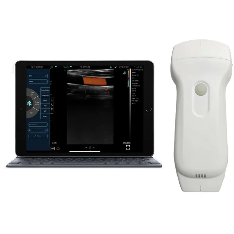 C10RL Ultrasound Vein Illumination System, Infrared Vein Viewer / Portable Vein Finder