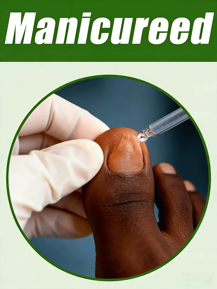 

Технологии меняют жизнь, набор инструментов для педикюра и восстановления ногтей