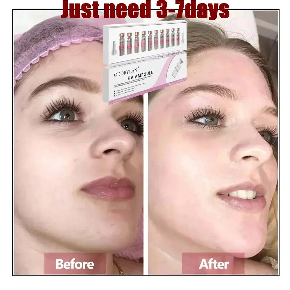 

Hyaluronic Acid Face Serum Essence Skin Repair Rejuvenation Firming Moisturizing Hydrating