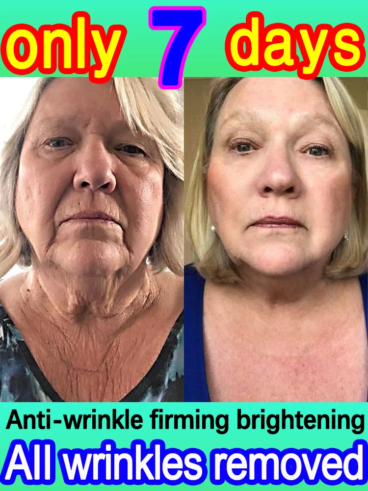 

Look 20 Years Younger Visibly Reduce Wrinkles Fast Anti Aging Treatment