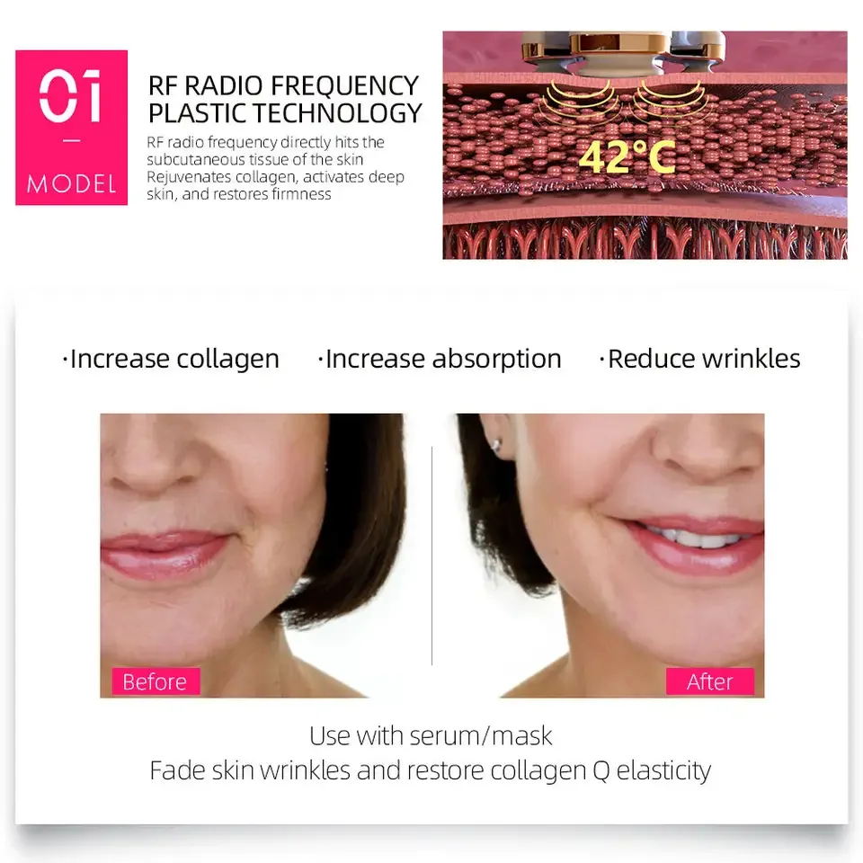 페이스 리프팅 기기 미용 제품 1 MHz 얼굴 탄력 마사지기 EMS 탄력 기기