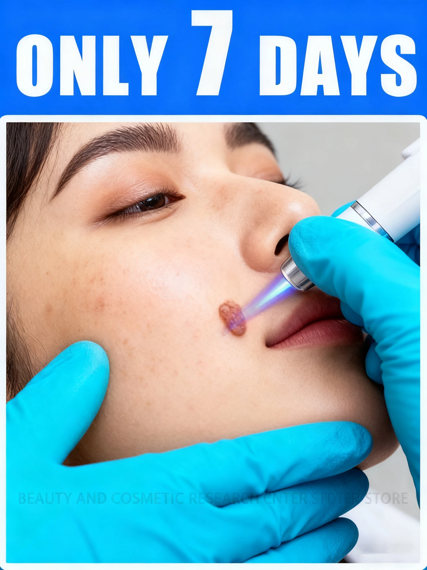 

Уникальное проникновение световой волны быстро входит бородавки безопасно, не оставляя следов.