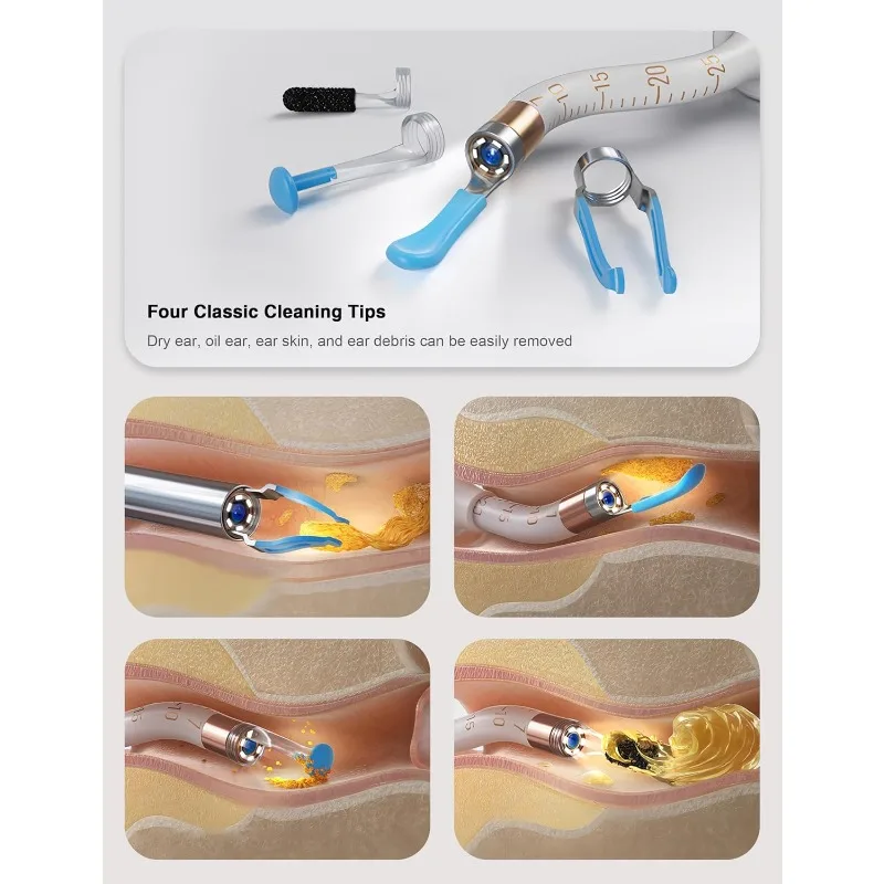 

Wax Removal Tool Camera with HD Visual Otoscope, Smart WiFi Earwax Cleaner Kit, Safe Silicone Flexible