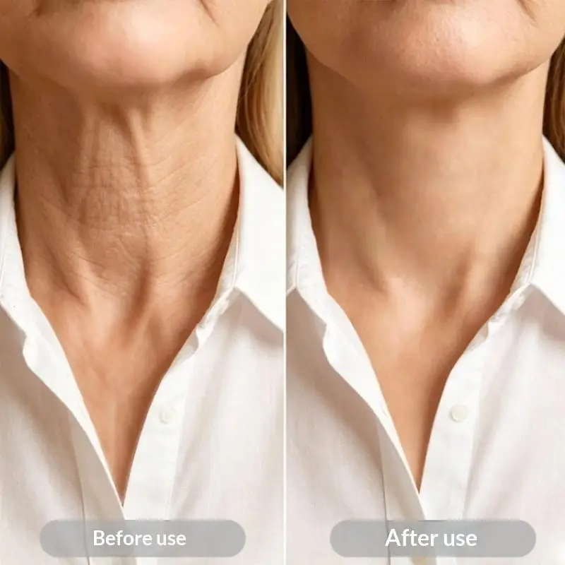 3/10pcs Neck Lifting Sticker Waterproof Invisible PU Film Skin-Friendly Anti-Aging Patches for Skincare Enthusiasts