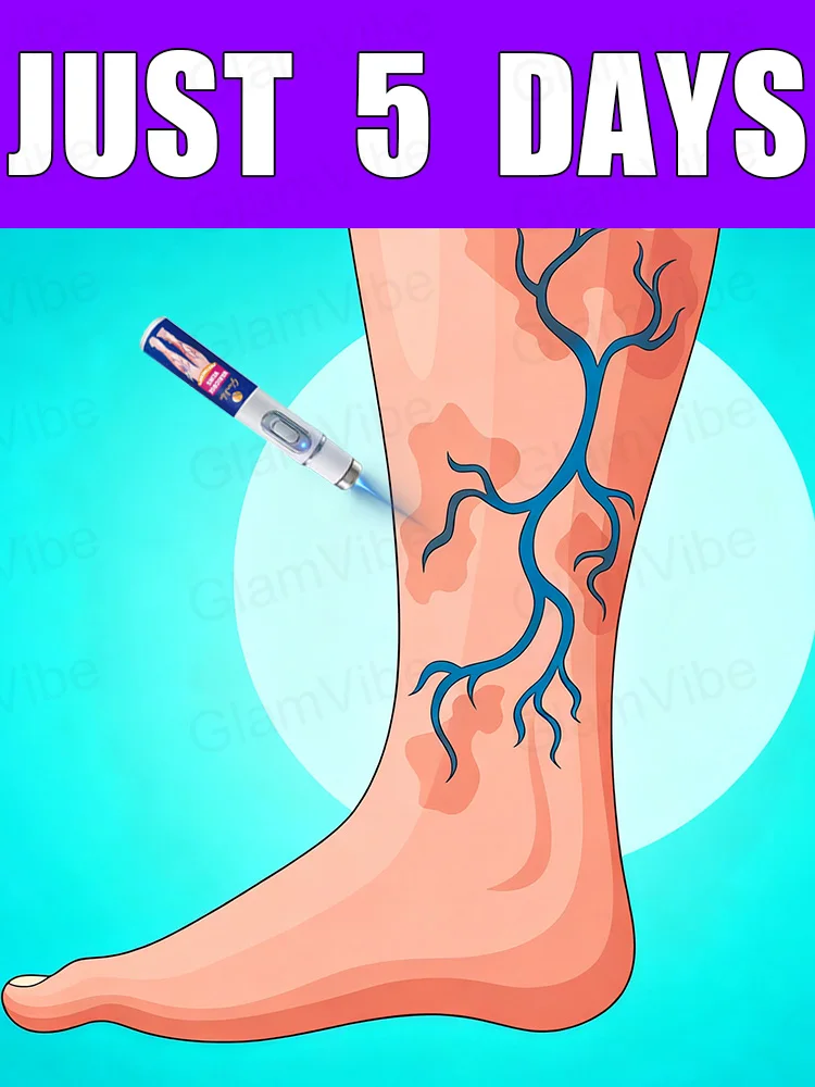 

Generation-2 Laser Says Goodbye To Spider Legs Varicose In 7 Days