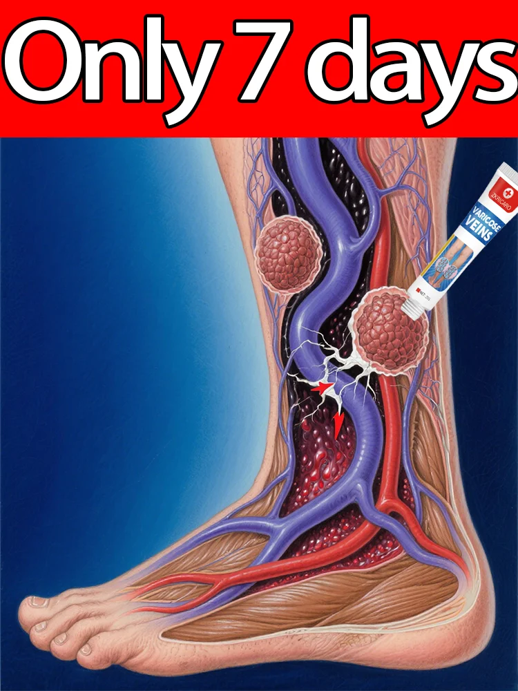 

Wᴇᴀʀ Sʜᴏʀᴛs Wɪᴛʜ Cᴏɴғɪᴅᴇɴᴄᴇ: Vᴀʀɪᴄᴏsᴇ Cʀᴇᴀᴍ Tʜᴀᴛ Sᴜᴘᴘᴏʀᴛs Yᴏᴜʀ Vᴇɪɴs