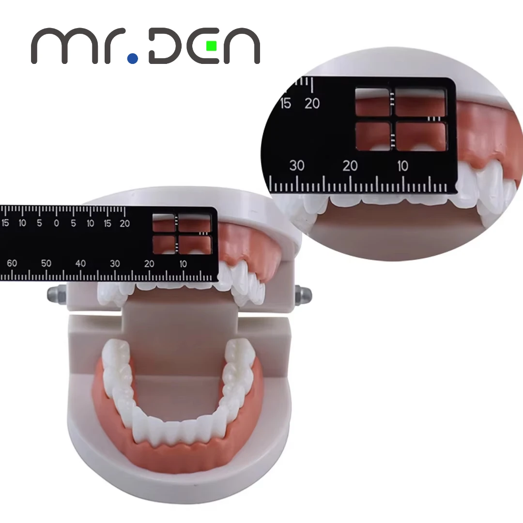 

Стоматологический прецизионный измерительный прибор, высокоточный медицинский инструмент для стоматологической фотографии
