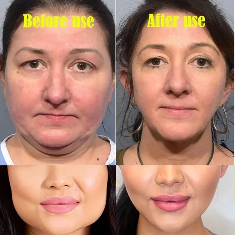 Crema dimagrante viso a forma di V rimuovi Double Chins rassodante Lifting Up V Cheek brucia grassi prodotti per la cura del massaggio modellante Anti Anti-età