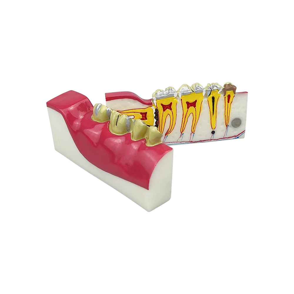 Dental Teeth Anatomical Model Right Posterior Tooth Cross Section Decomposition Model Dentistry Teaching Demonstration Models