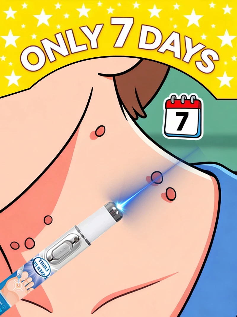 

Новинка 2026: Синий световой карандаш для удаления подмышечных и генитальных бородавок, инструмент для ухода