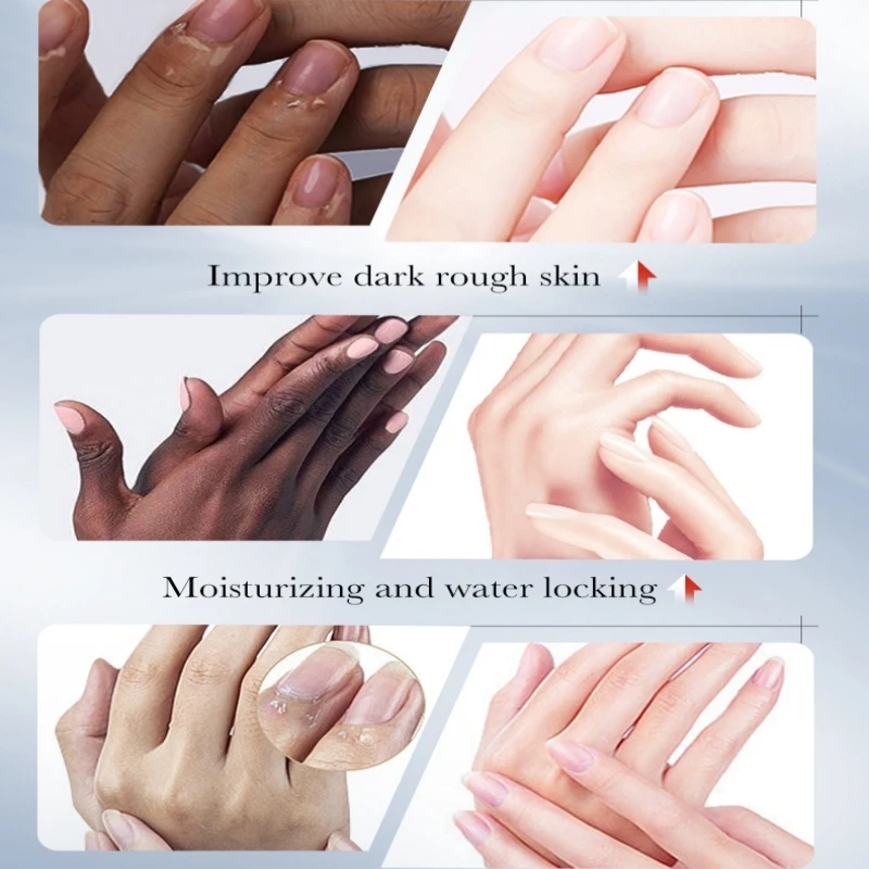 Kojic Acid Whiteing Moisturizing Hand Cream Anti-drying Smooth Nourish Lightening Black Skin Brightening Korean Autum Skin Care