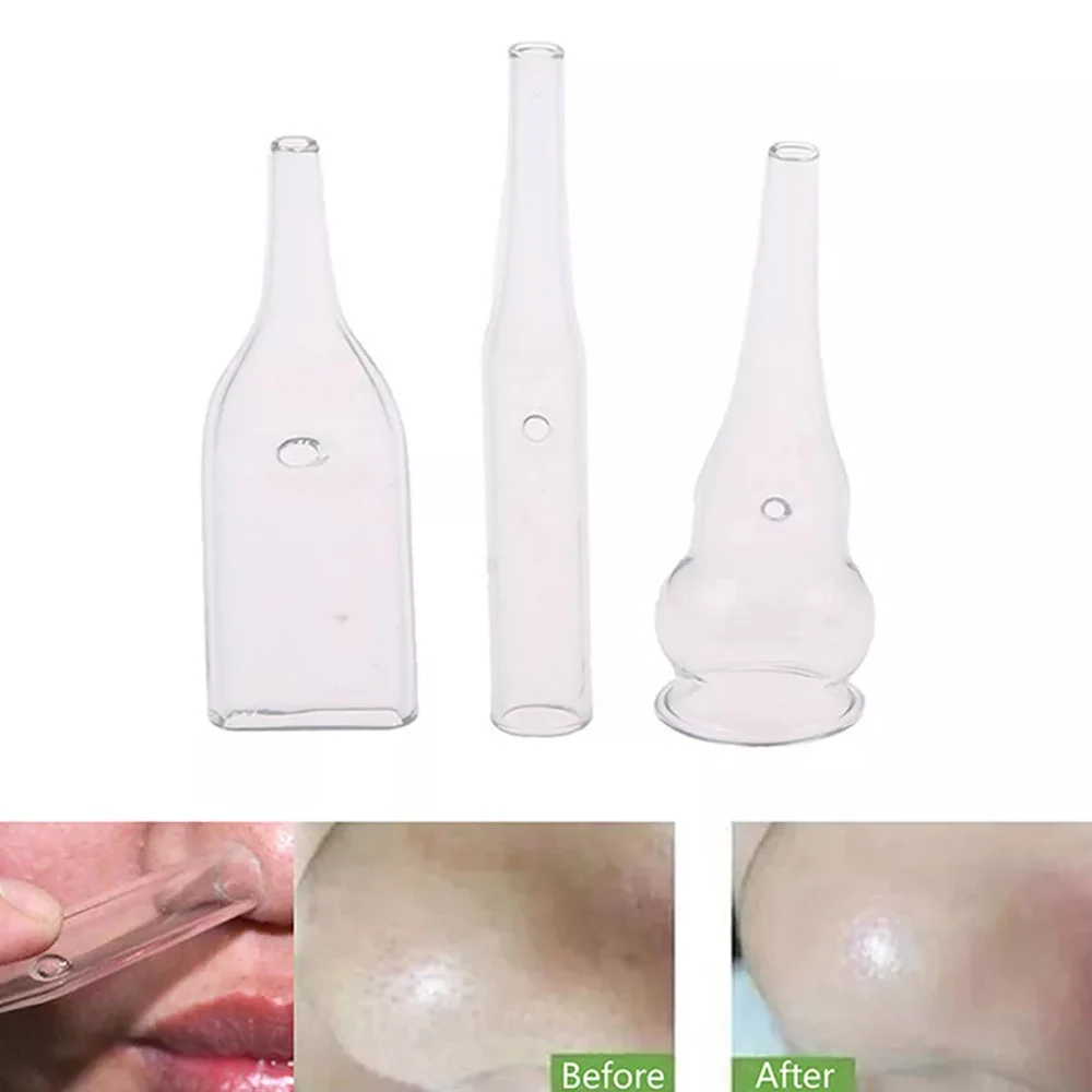 1 PC ดูดสูญญากาศ Tube Face Pore Cleanser ท่อแก้ว Blackhead Removal EXTRACTOR ความงามเครื่อง Facial Skin Care อุปกรณ์เสริม
