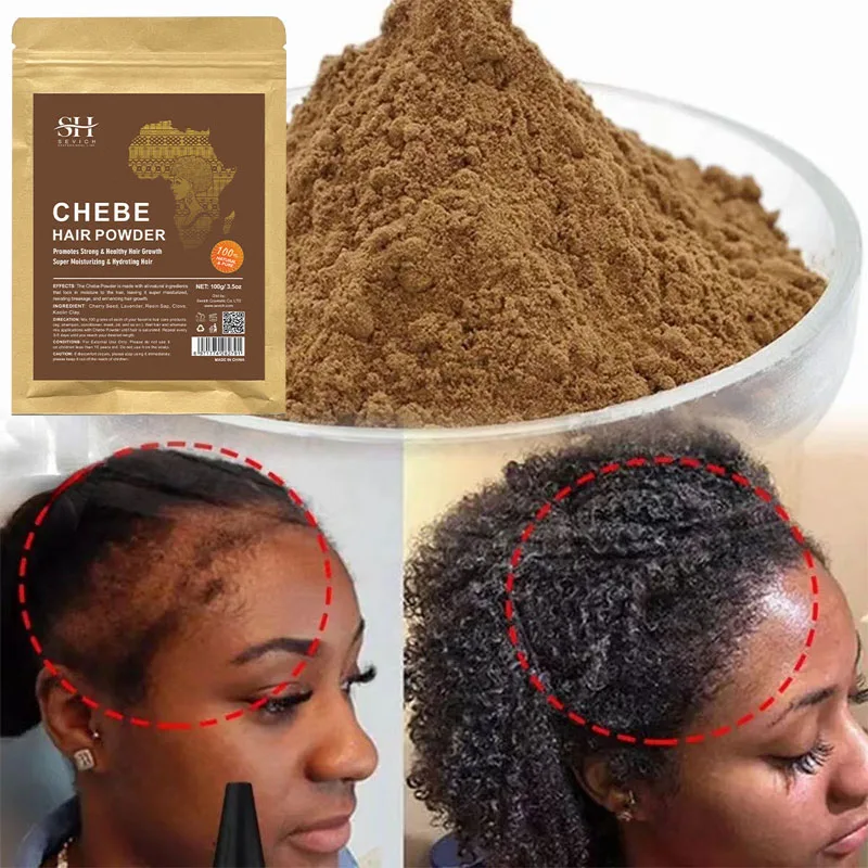 Rapid hair loss treatment for African hair growth and prevention of hair loss strenghthen and lengthen 100g