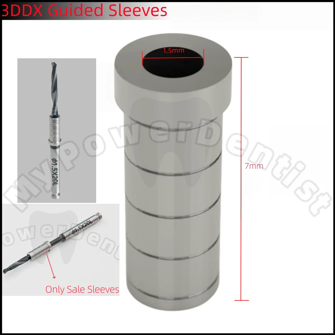 Dental 3DDX Guide Sleeves Fixation Implant Guided Sleeves Digital Application 1.5